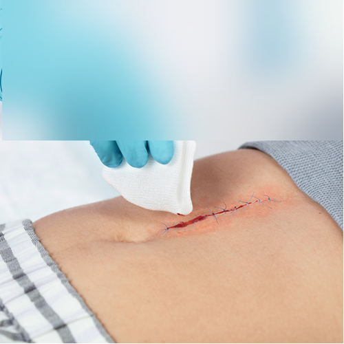 Close-up van de blote knieën van een jongen. Zijn rechterknie is geschaafd; links draagt hij een wondverband.  Close-up van de blote knieën van een jongen. Zijn rechterknie is geschaafd; links draagt hij een wondverband.